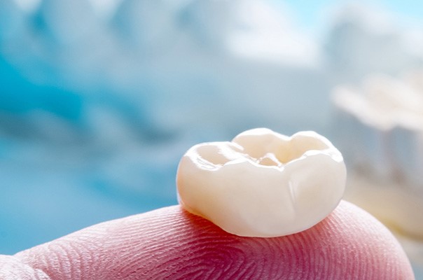 Завершена работа над заказным маркетинговым исследованием рынка керамических протезов для стоматологии и ортопедии